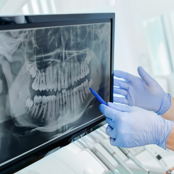 Dentist pointing to digital x rays of teeth