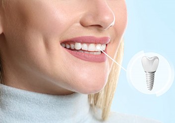 a woman smiling with a new dental implant