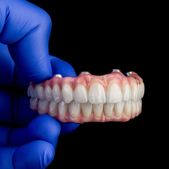 An older man smiling with implant dentures