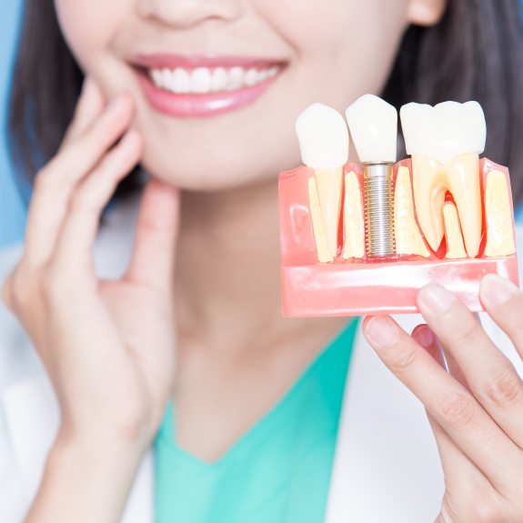 Dentist holding a model of a dental implant in the mouth